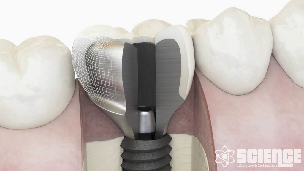 EN 45502-1 Cerrahi İmplantlar Testi