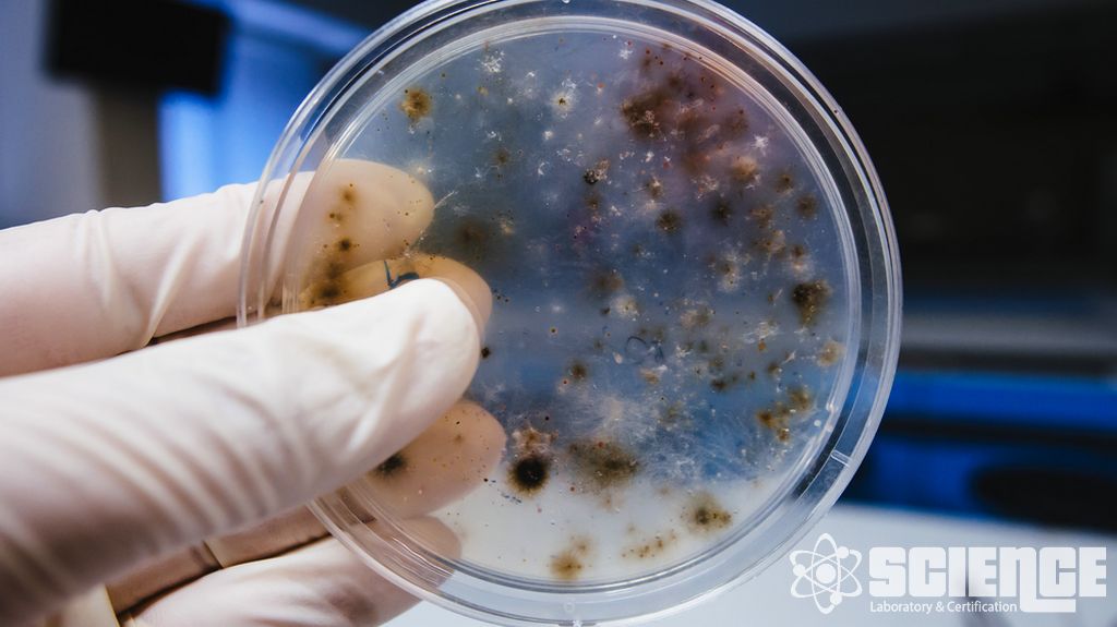 Mantar Direnci Testi