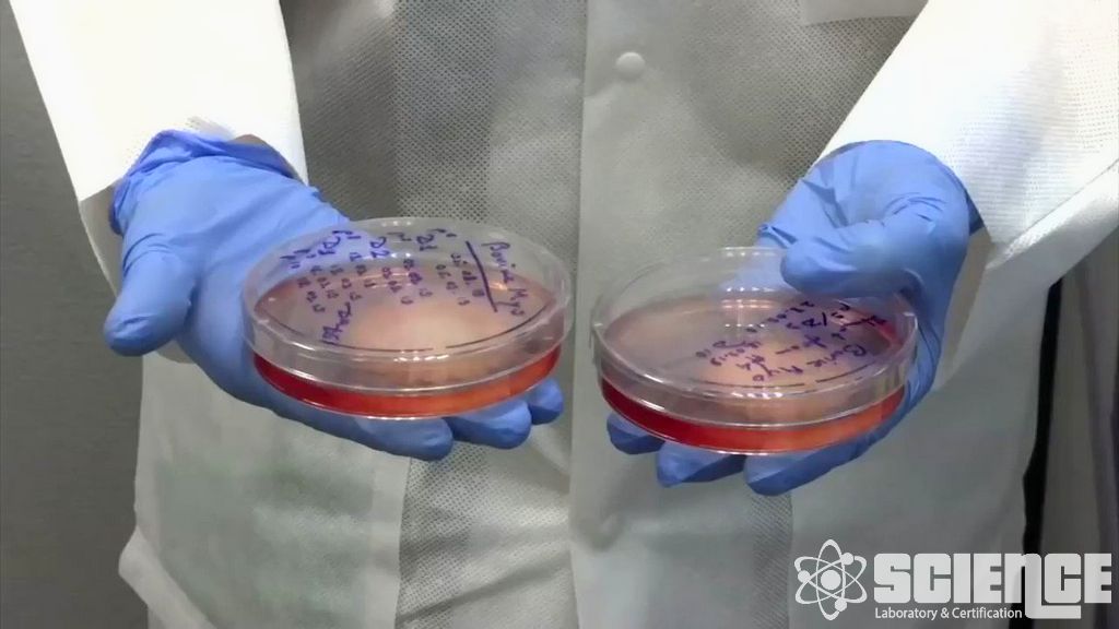 Sterilizasyon Biyolojik Yük Direnci Testi