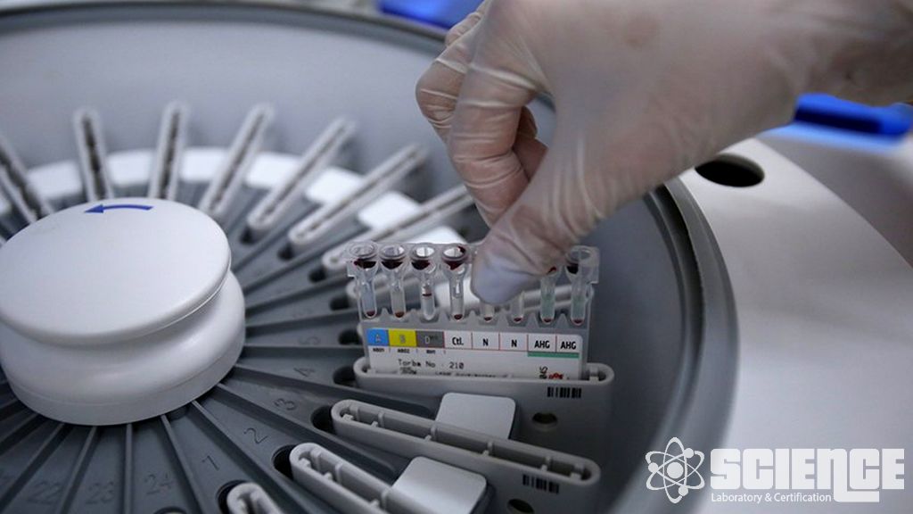 Toksikoloji Testleri